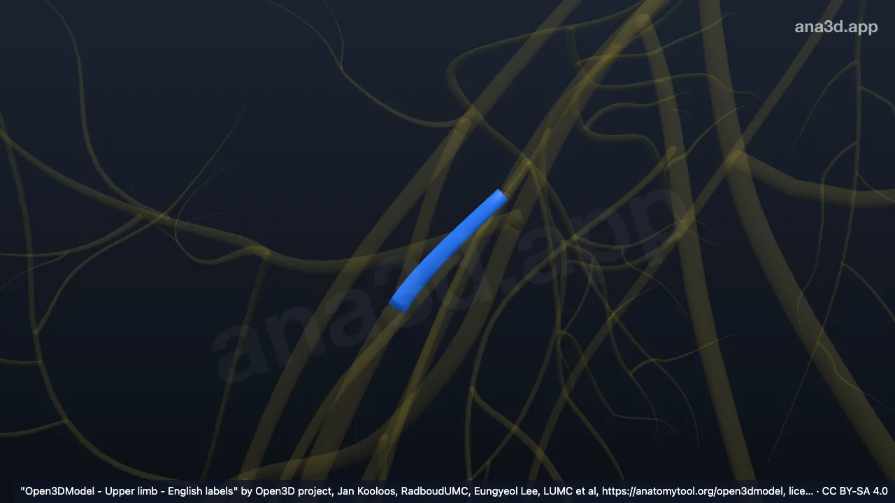 3D-Modell: Rechte Radix medialis des Nervus medianus