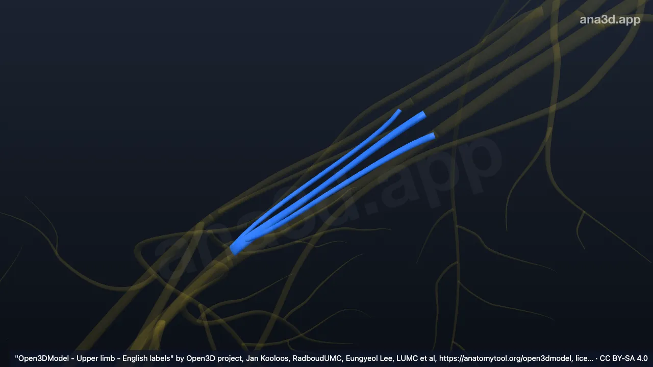 Model 3D: Divisi-divisi posterior pleksus brakialis kanan