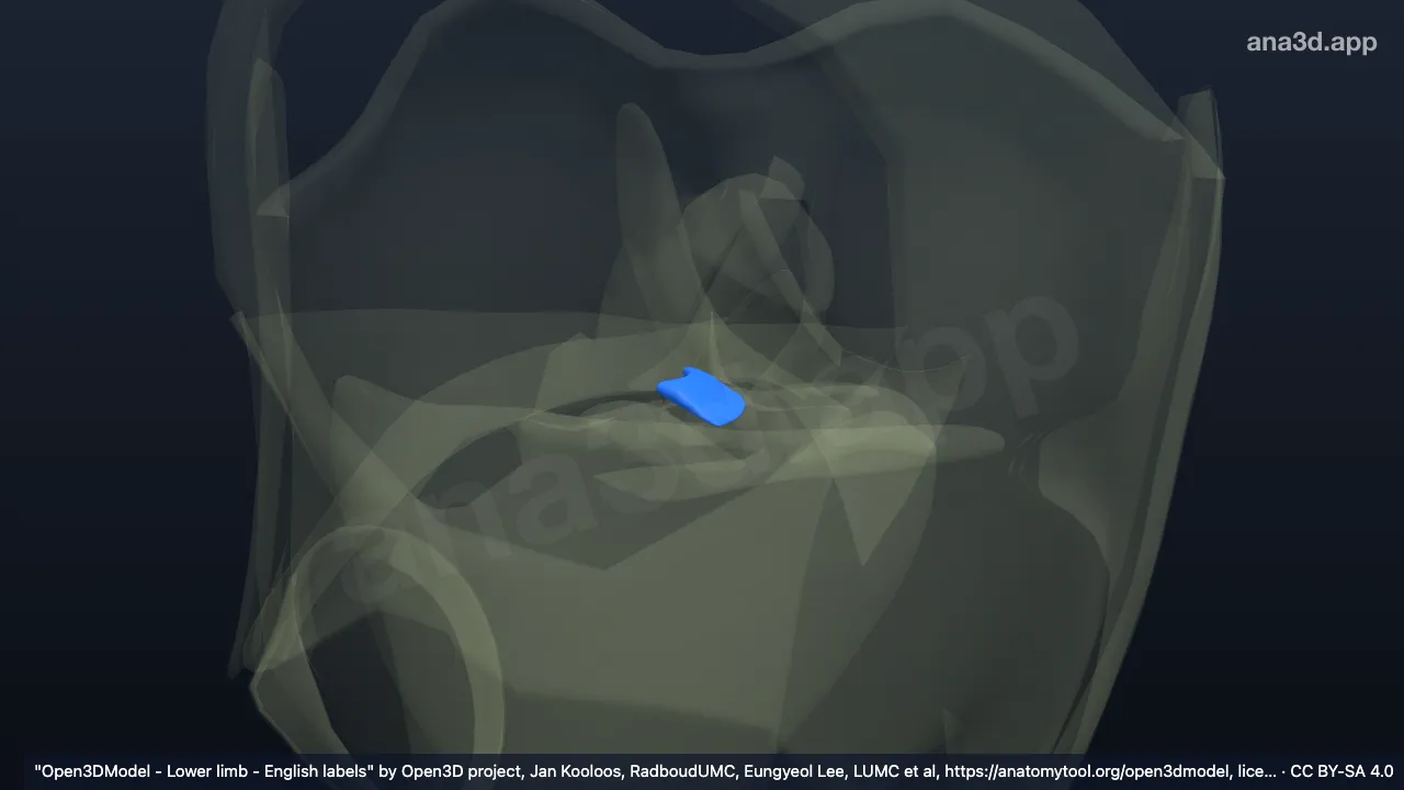 Modelo 3D: Corno posterior do menisco lateral direito