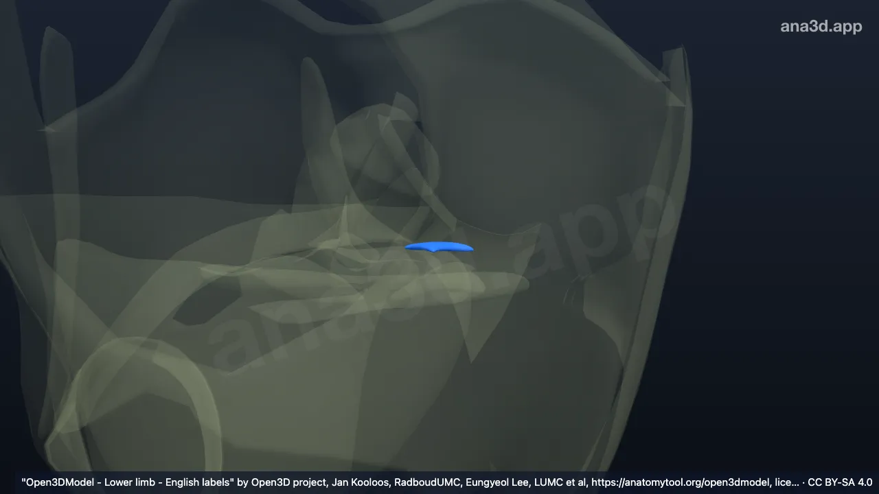 Modelo 3D: Corno posterior do menisco medial direito