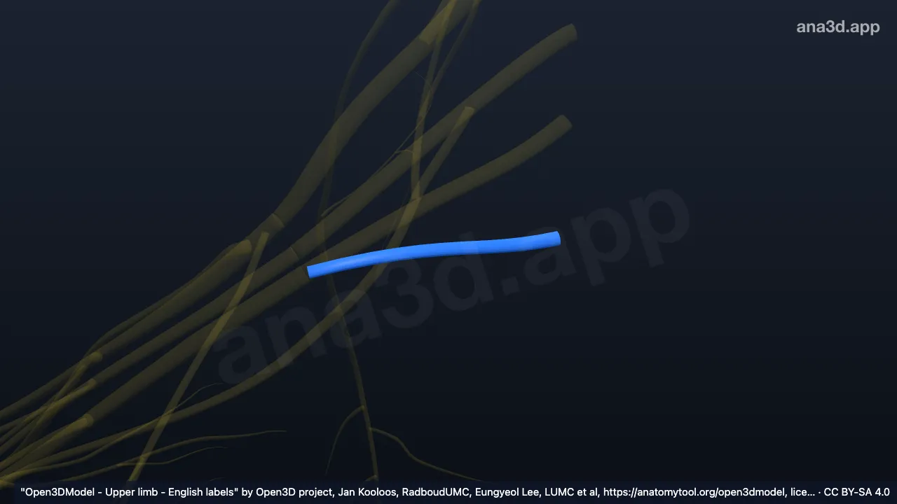3D 模型：右T1神经根