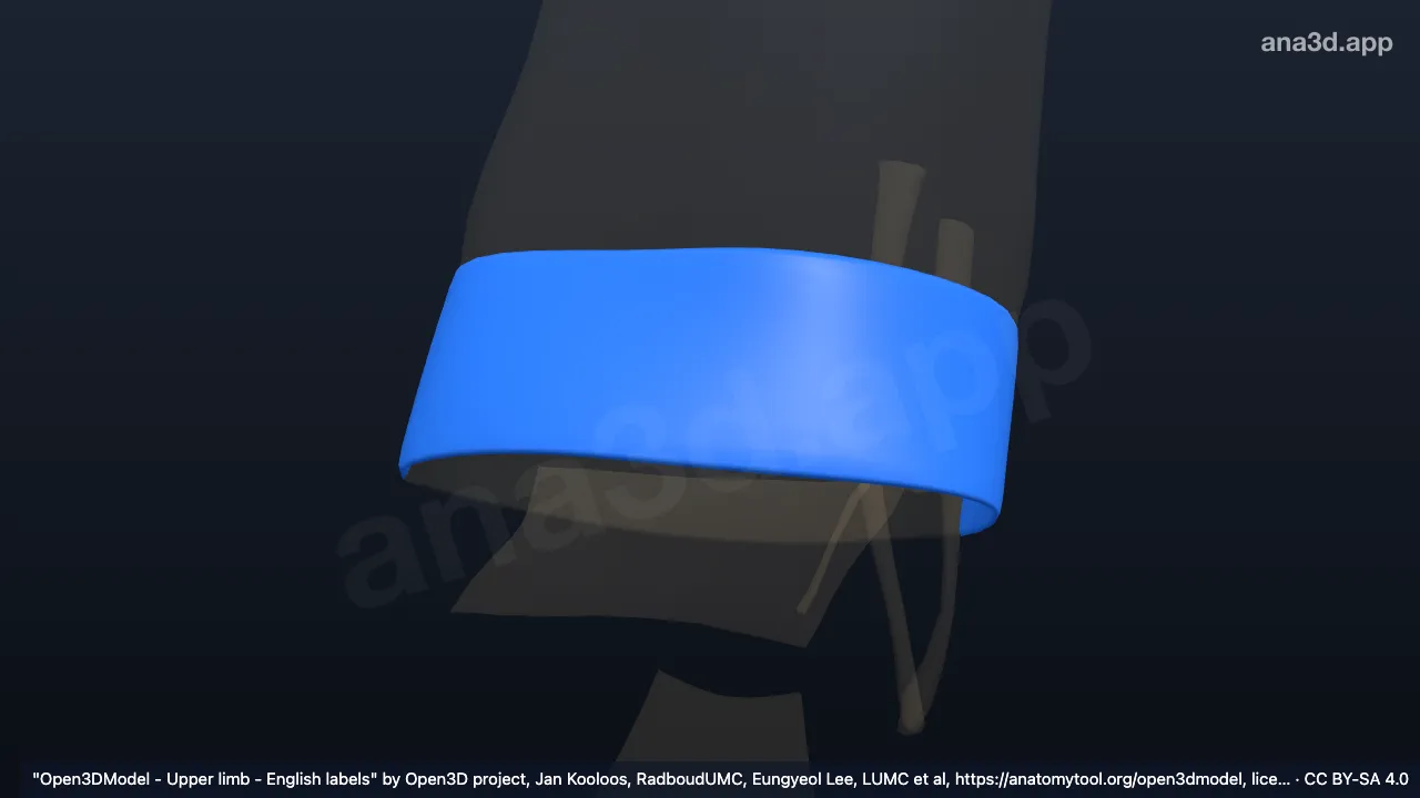 Modelo 3D: Parte engrosada de la fascia antebraquial derecha
