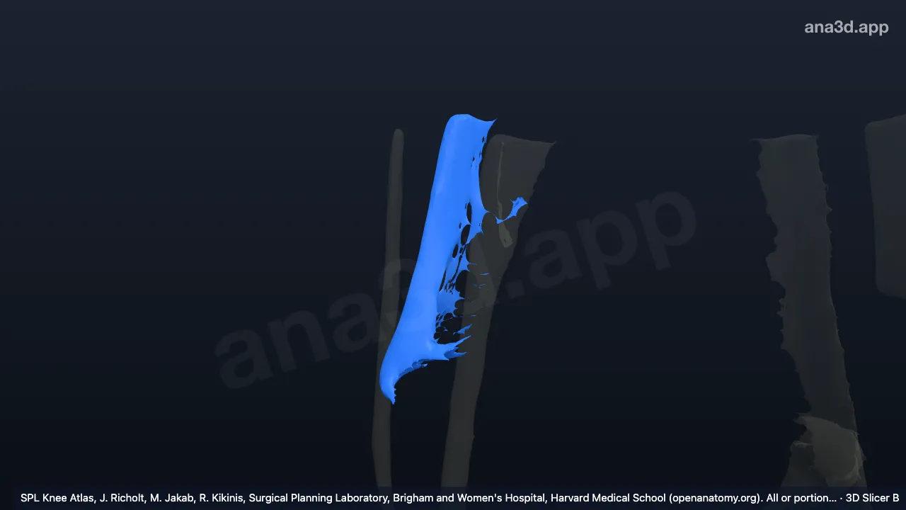 3D model: adductor magnus tendon