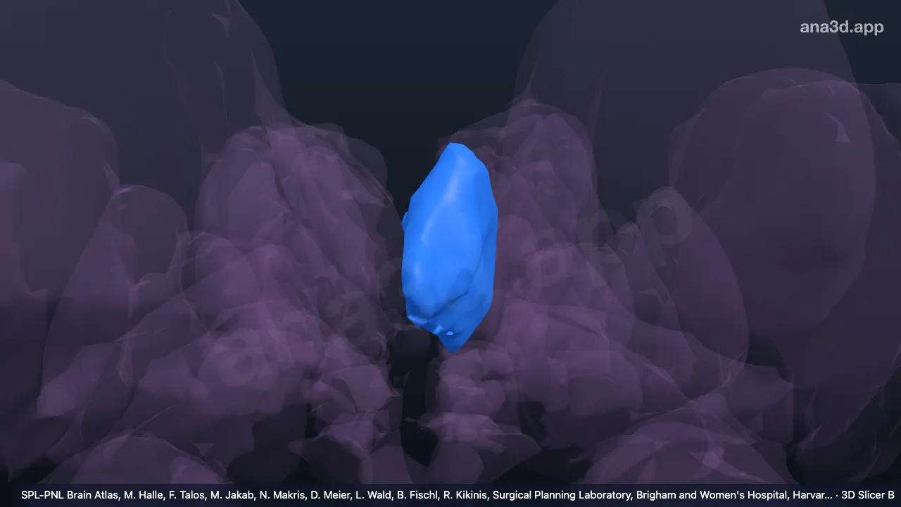 3D-Modell: Linker Nucleus dorsomedialis thalami