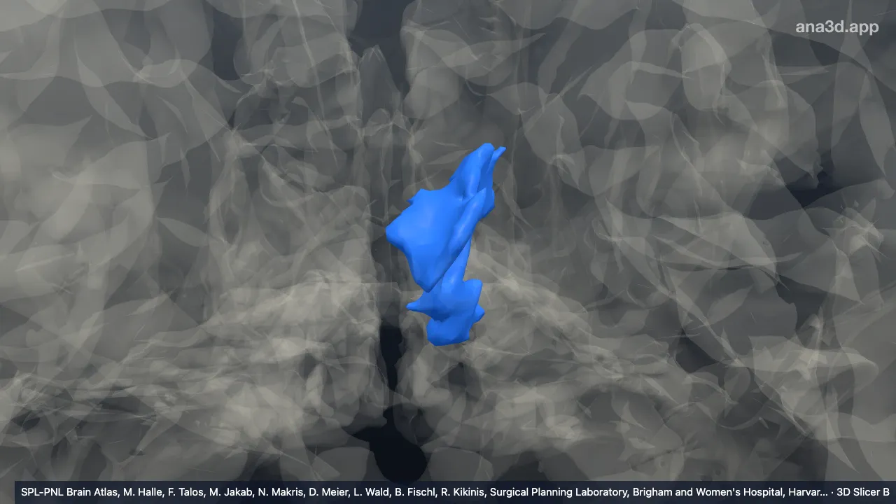 3D-Modell: Linke Lamina medullaris interna