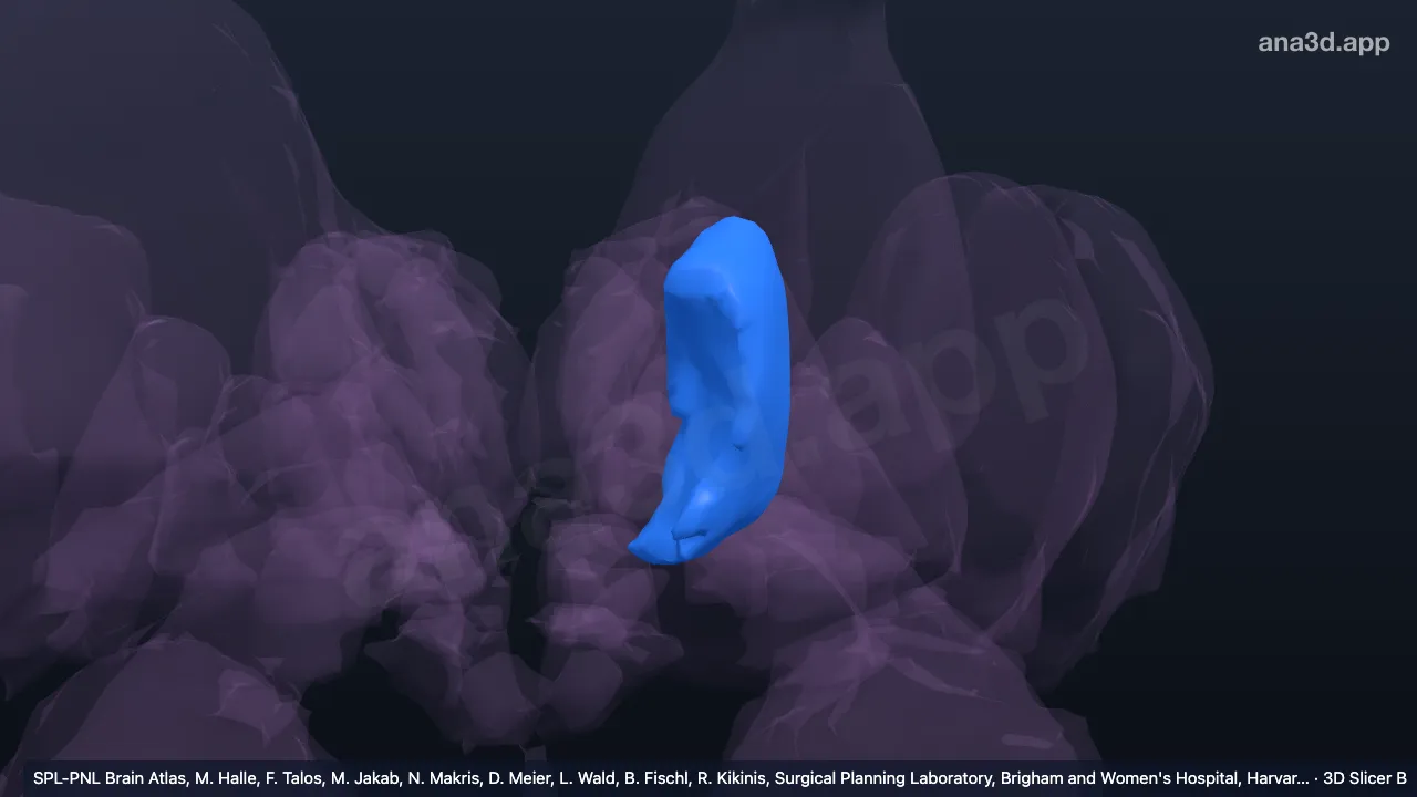 3D 模型：左丘脑腹外侧核
