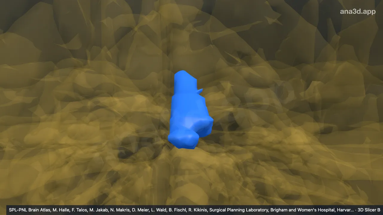 Modelo 3D: VI-v izquierdo