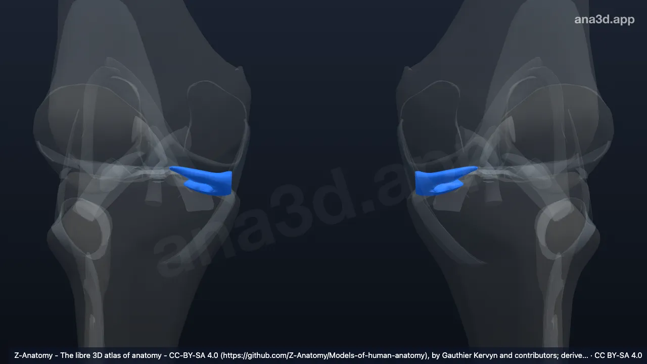 3D model: medial meniscus