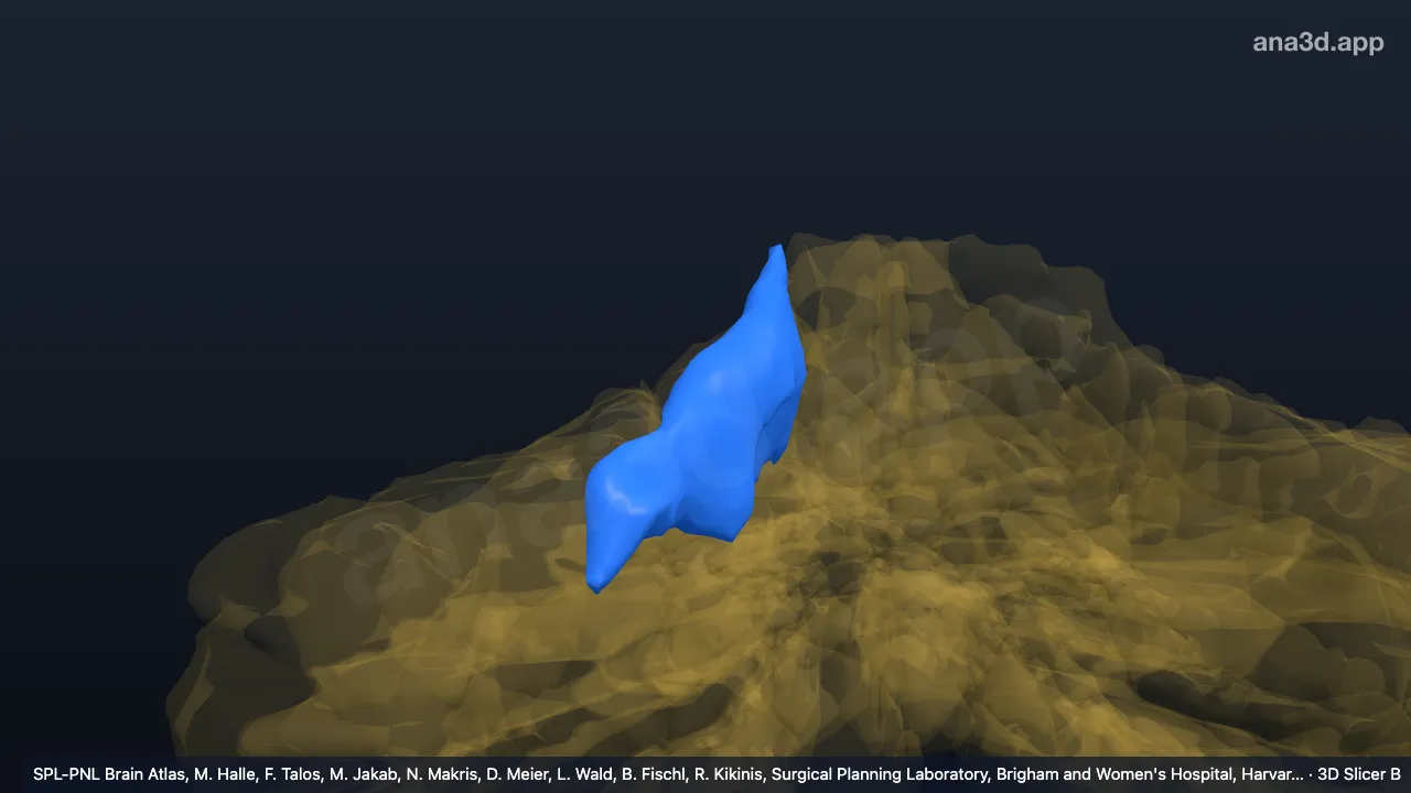 3D model: right IV-m