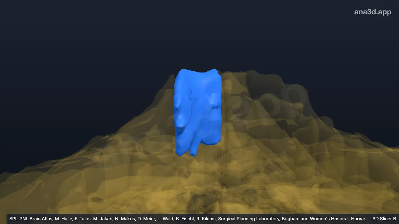 Modèle 3D : IV-v droit
