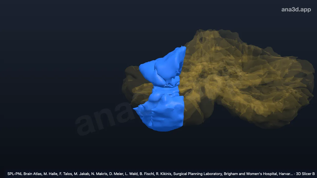 3D model: right lateral hemispheric zone 1