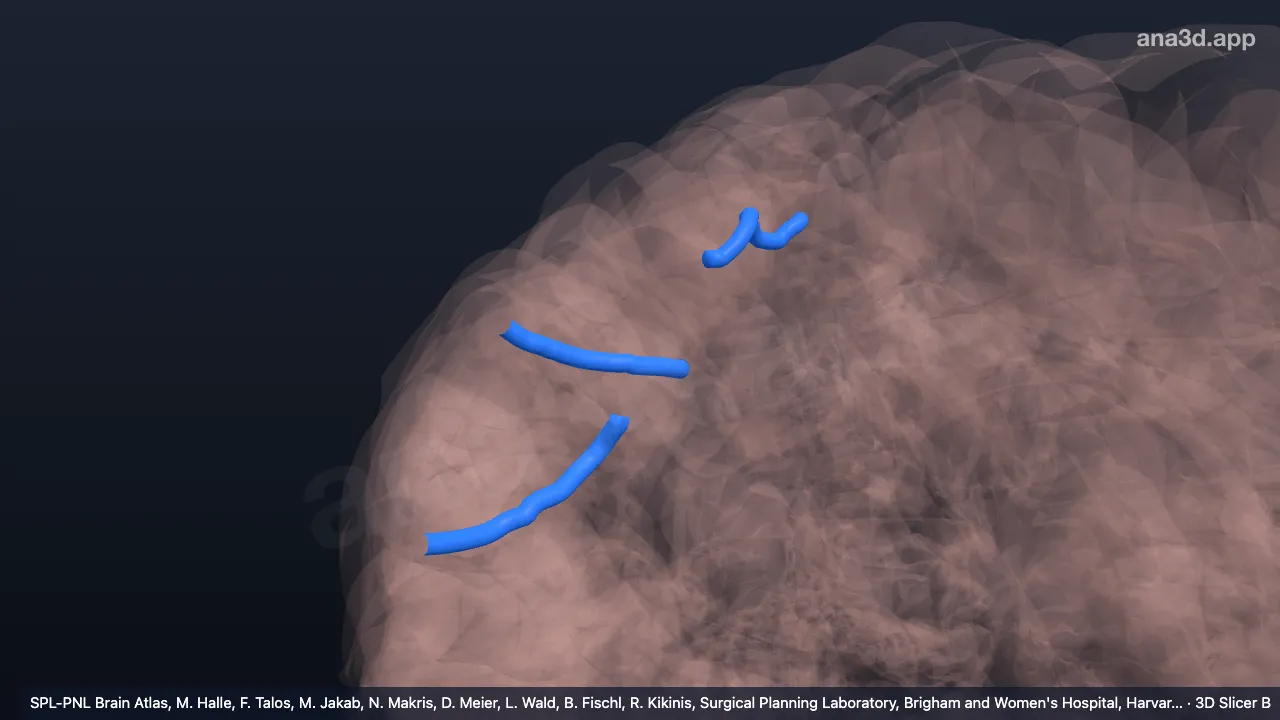 3D model: right precentral sulcus