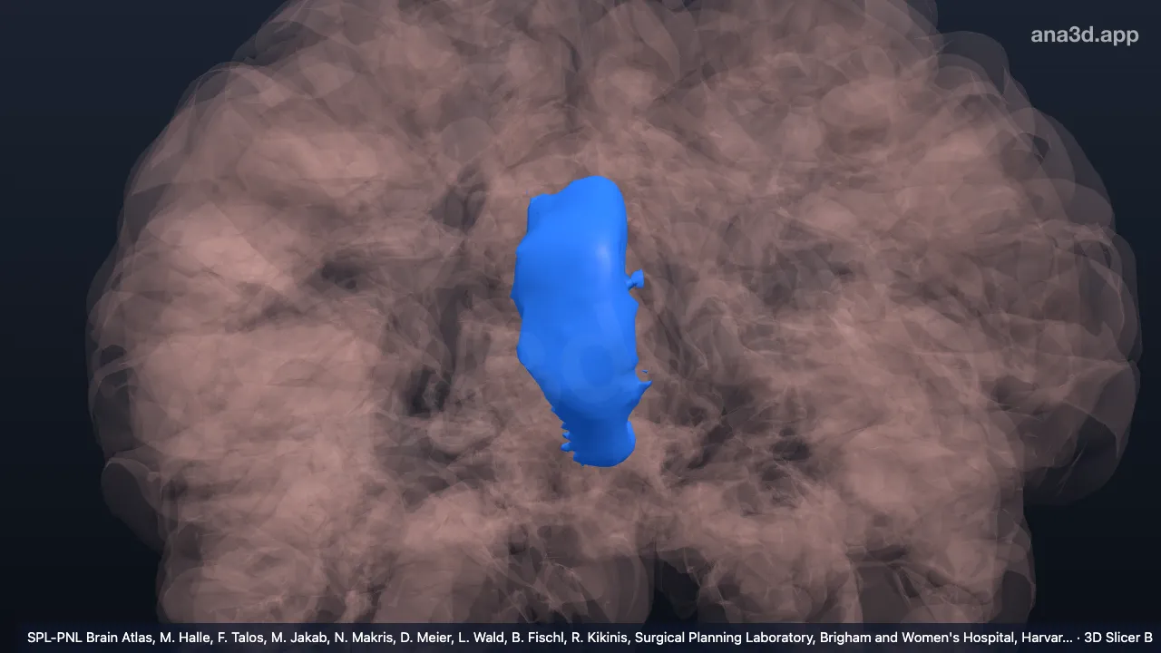 Modelo 3D: Parte rostral do giro do cíngulo anterior direito