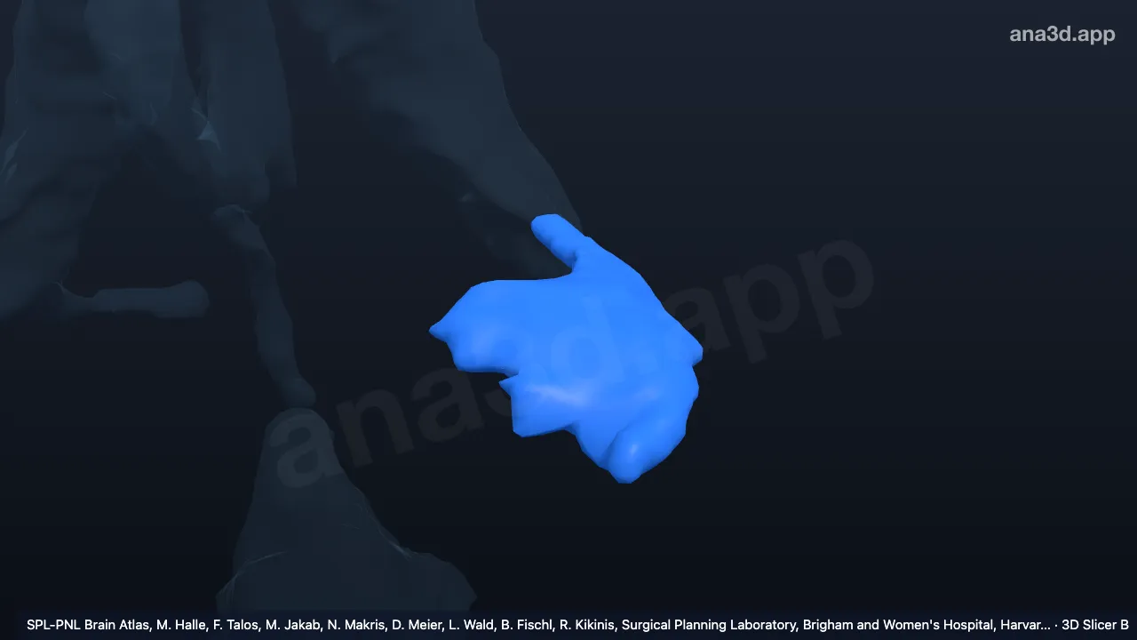 Modelo 3D: Corno temporal do ventrículo lateral esquerdo