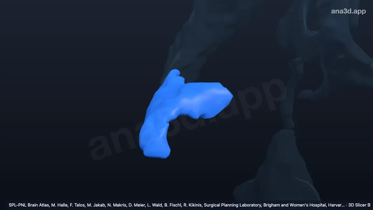 Modelo 3D: Corno temporal do ventrículo lateral direito