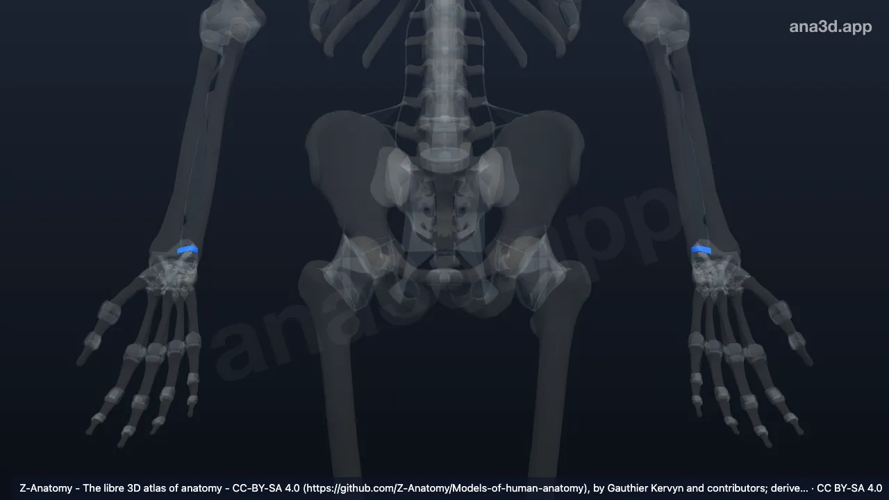 3D-Modell: Ligamentum radioulnare palmare