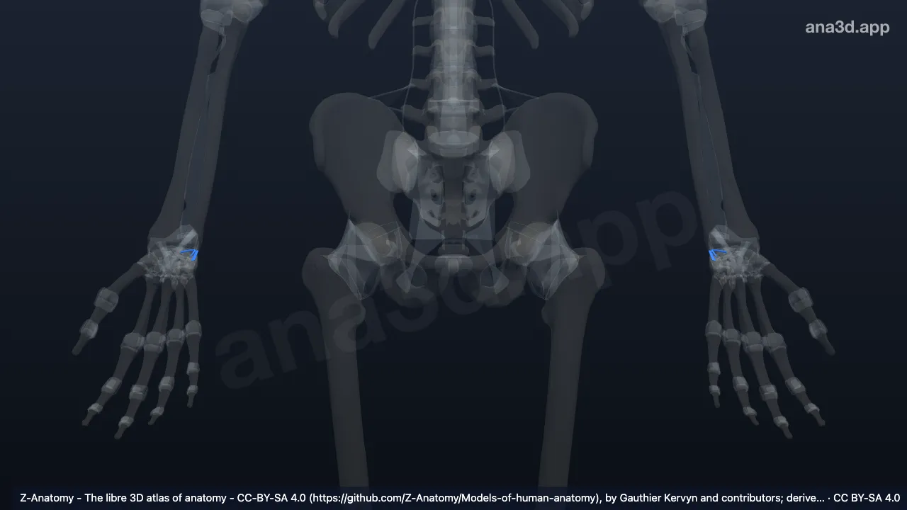 3D model: dorsal ulnocarpal ligament