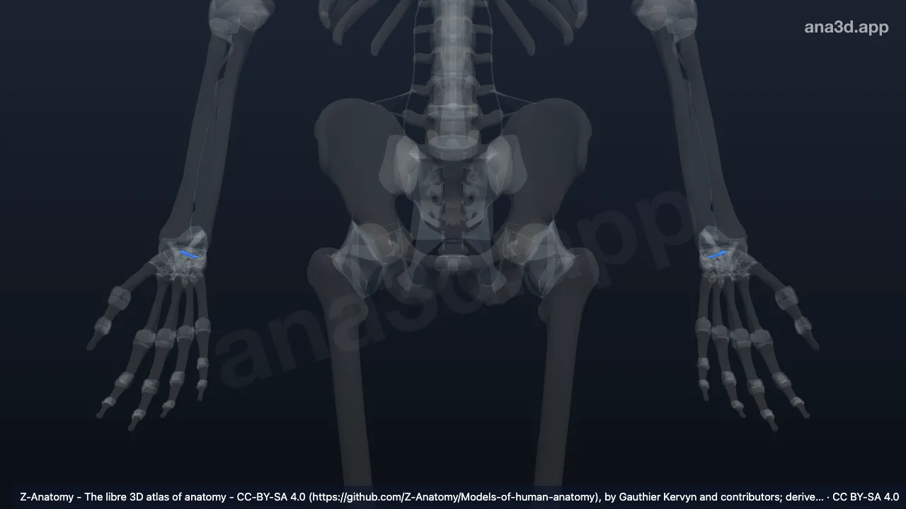 Modelo 3D: Ligamento escapotriquetral palmar