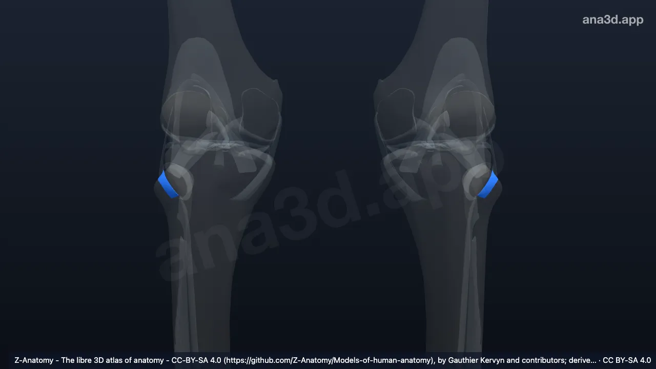 Mô hình 3D: Dây chằng chỏm xương mác trước