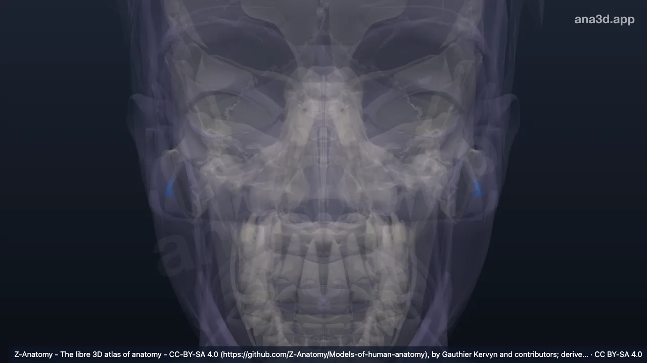 Mô hình 3D: Khuyết gian bình