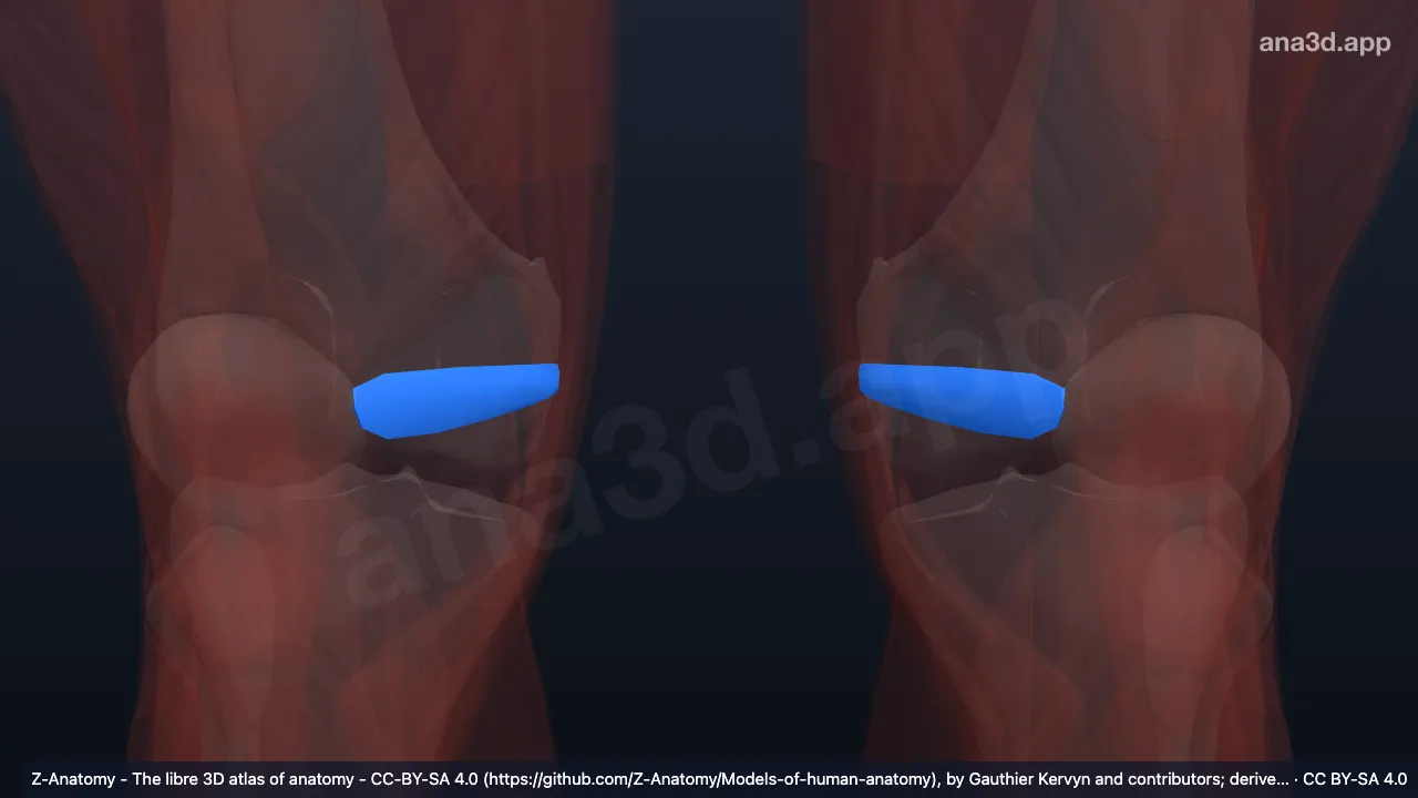 3Dモデル：内側膝蓋支帯
