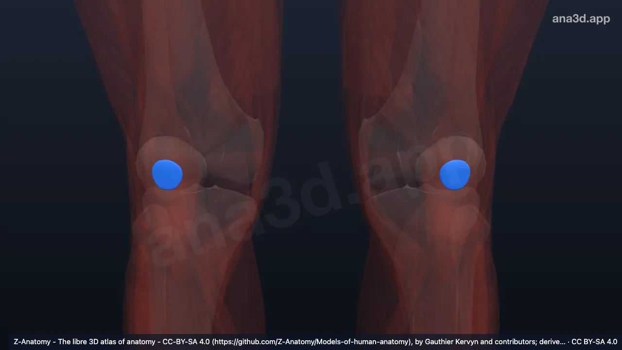Modelo 3D: Bolsa prepatelar subcutánea