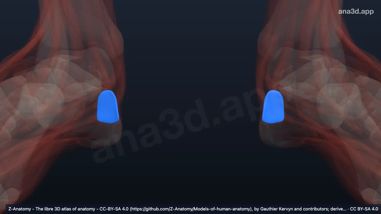 Modelo 3D: Bolsa calcânea subcutânea