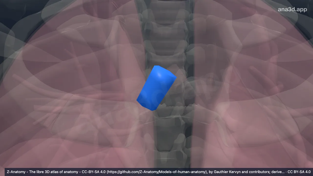 Model 3D: Bronkus utama kanan