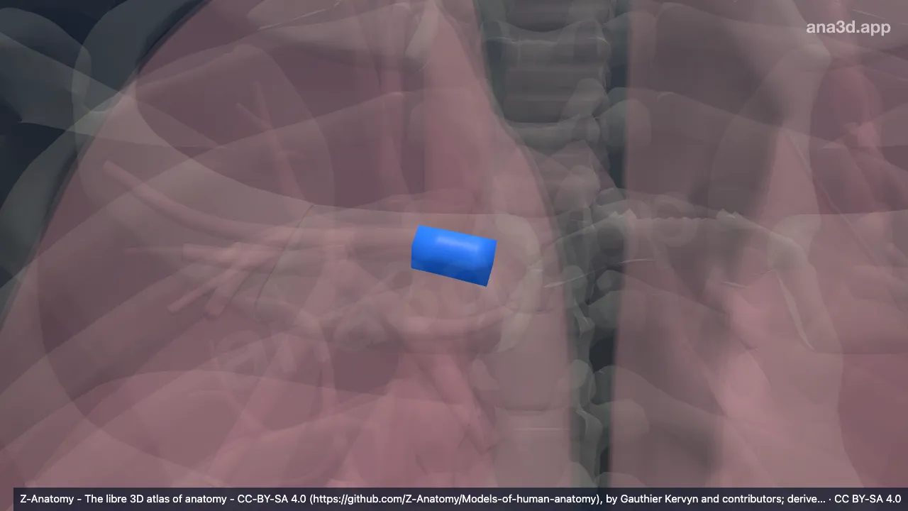 Modelo 3D: Bronquio lobar superior derecho