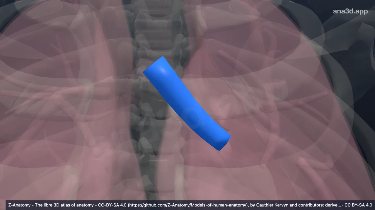 3D-Modell: Linker Hauptbronchus