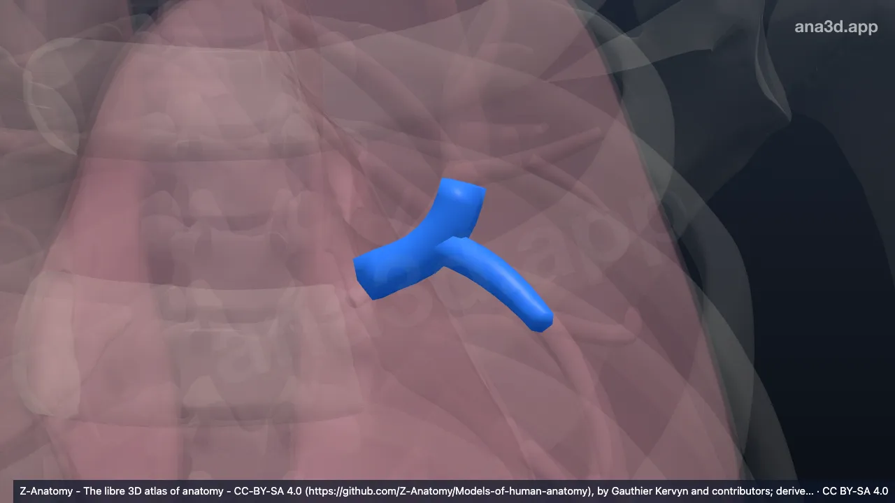 3D-Modell: Linker Bronchus lobaris superior