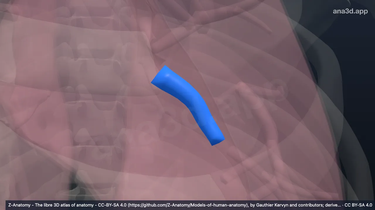 3D model: left inferior lobar bronchus