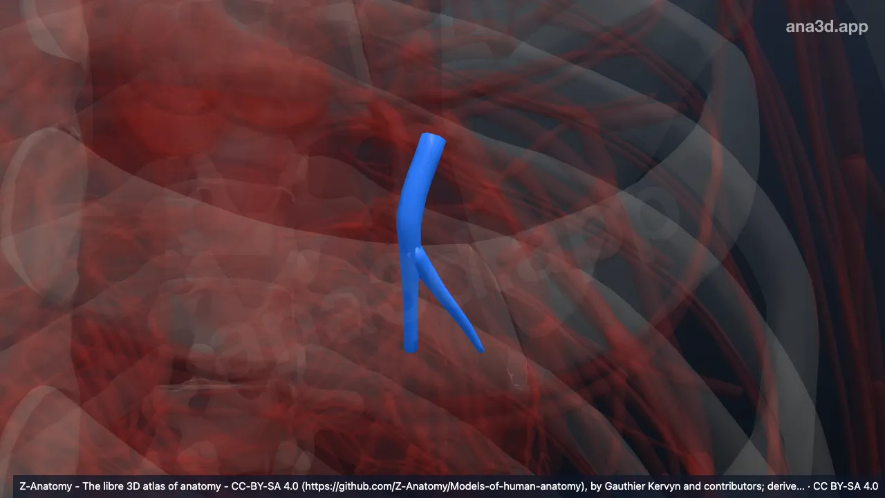 Modelo 3D: Artéria basal segmentar medial do pulmão esquerdo