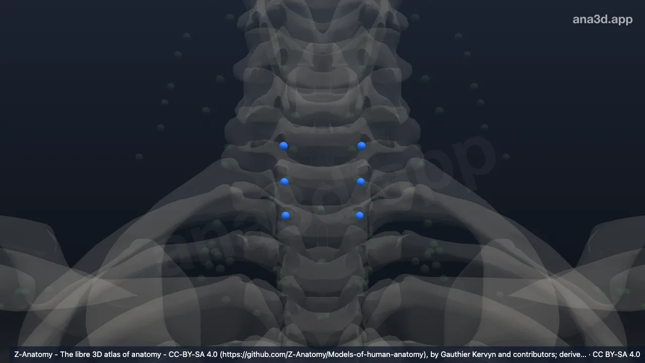 Modelo 3D: Nódulos cervicais paratraquéais