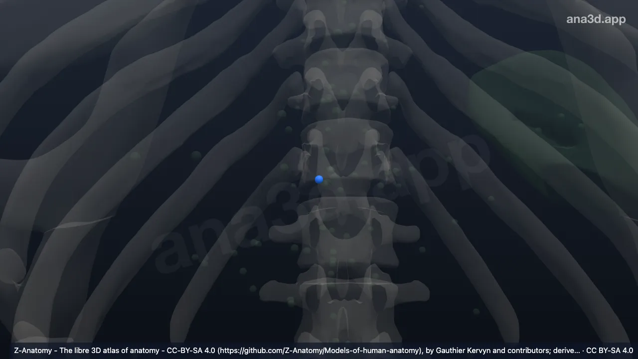 3D model: (Suprapyloric node)
