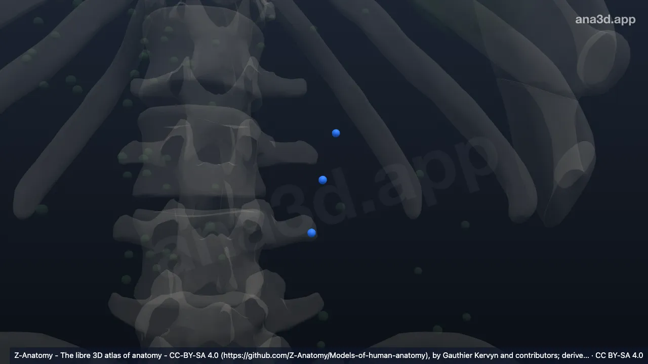 3D 模型：左结肠淋巴结
