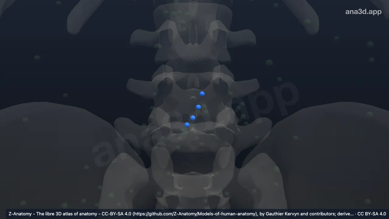 3D-Modell: Nodi lymphoidei iliaci communes intermedii