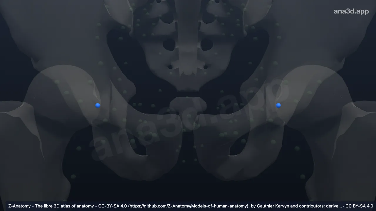 Modelo 3D: (Nodo lacunar lateral)