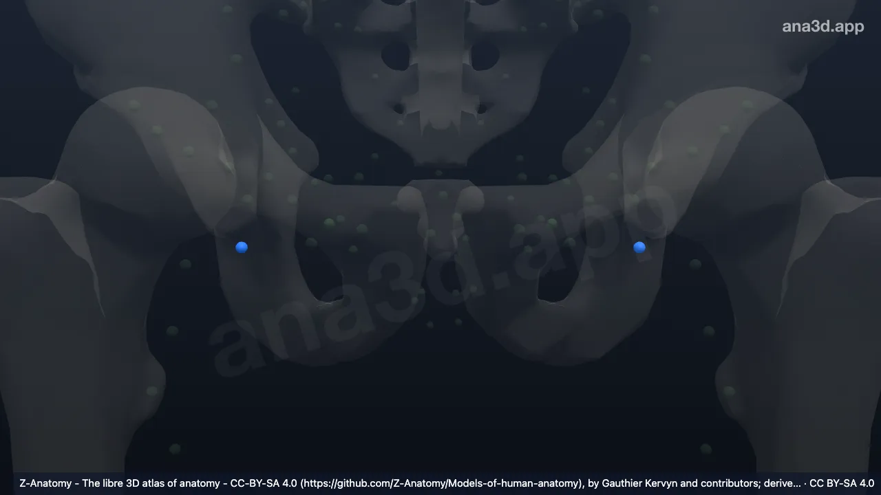 3D model: (Intermediate deep inguinal node)