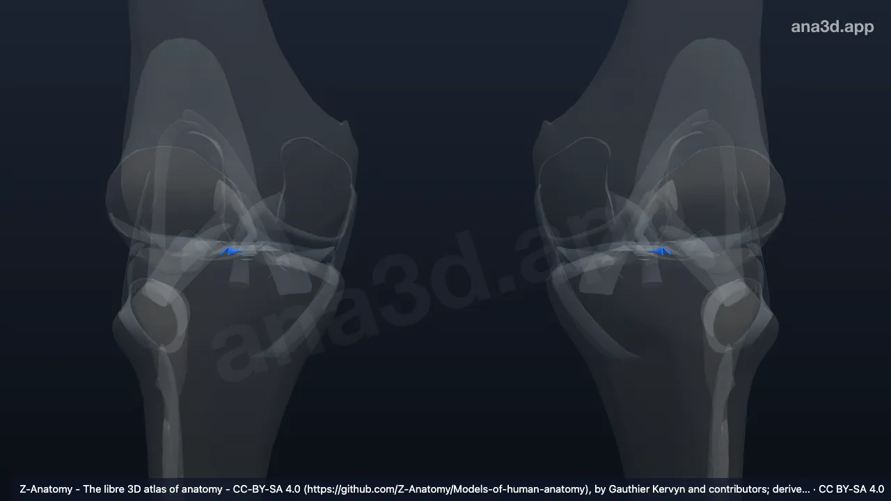3D model: anterior meniscotibial ligament (Lateral meniscus)