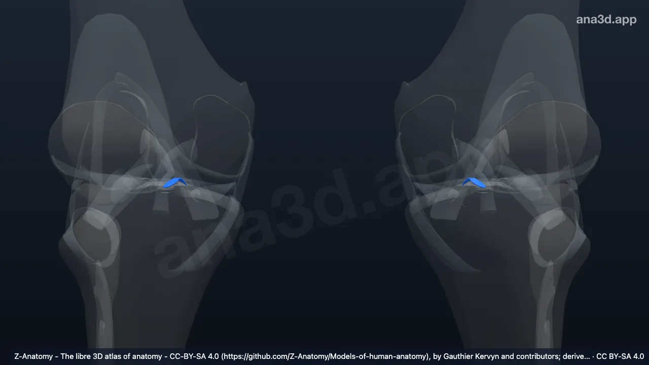 3Dモデル：前半月脛骨靱帯(内側半月)