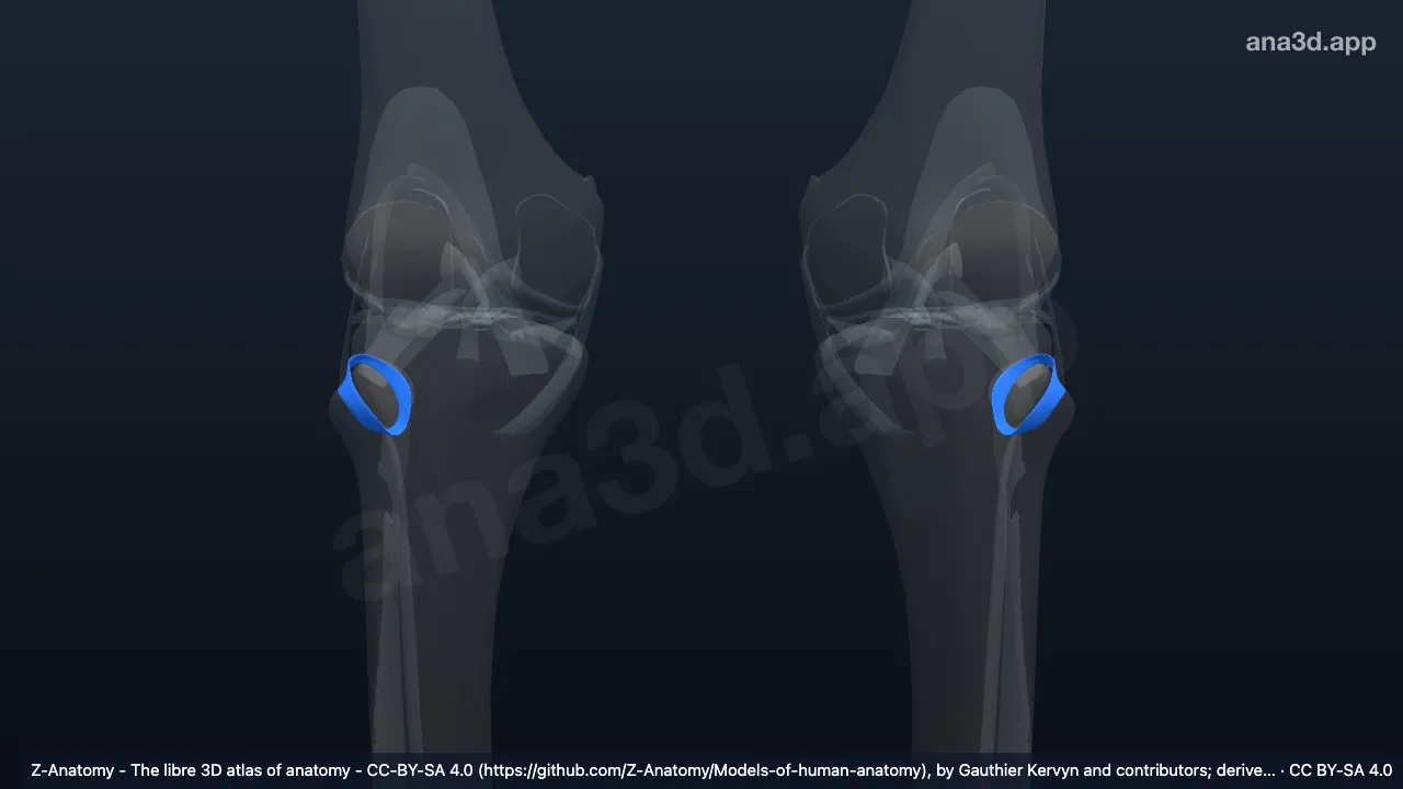 3D-Modell: Gelenkkapsel der Articulatio tibiofibularis superior