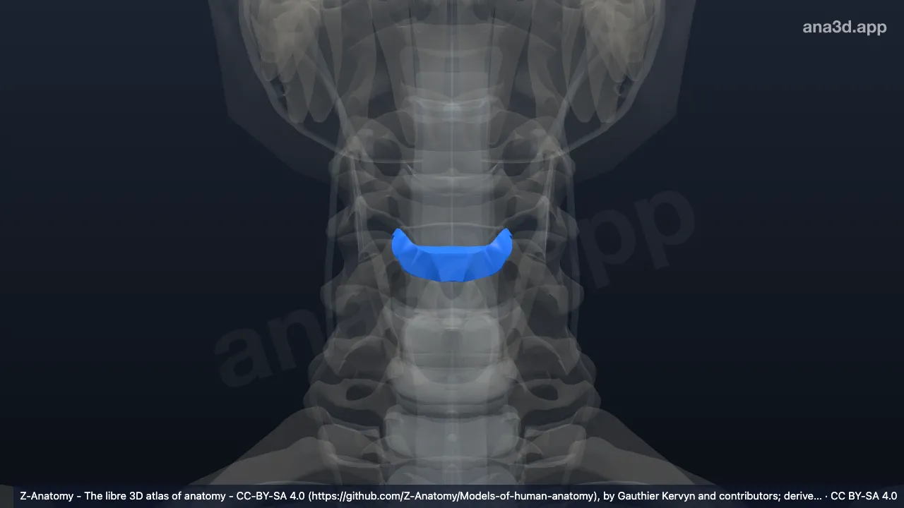 3D model: intervertebral disc C4-C5