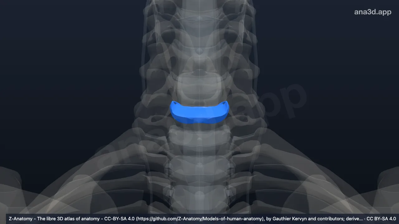 3D model: intervertebral disc C6-C7