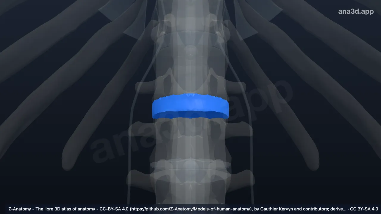 Model 3D: Diskus intervertebralis L1-L2