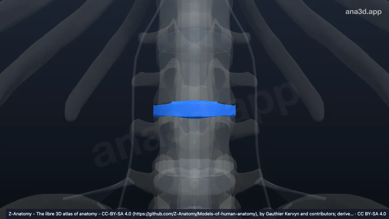 3D model: intervertebral disc L2-L3