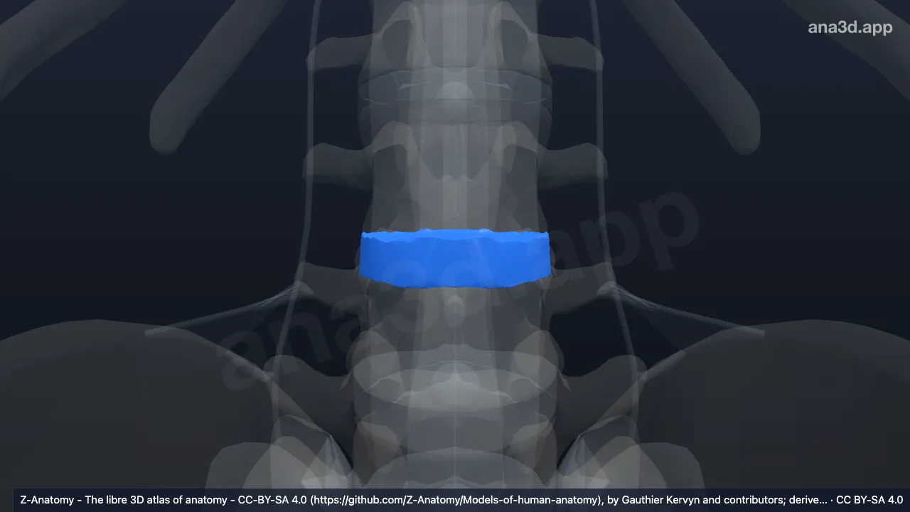 Modelo 3D: Disco intervertebral L3-L4