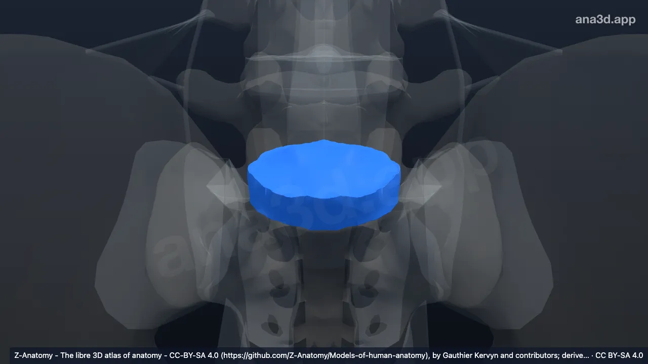 Model 3D: Diskus intervertebralis L5-S1