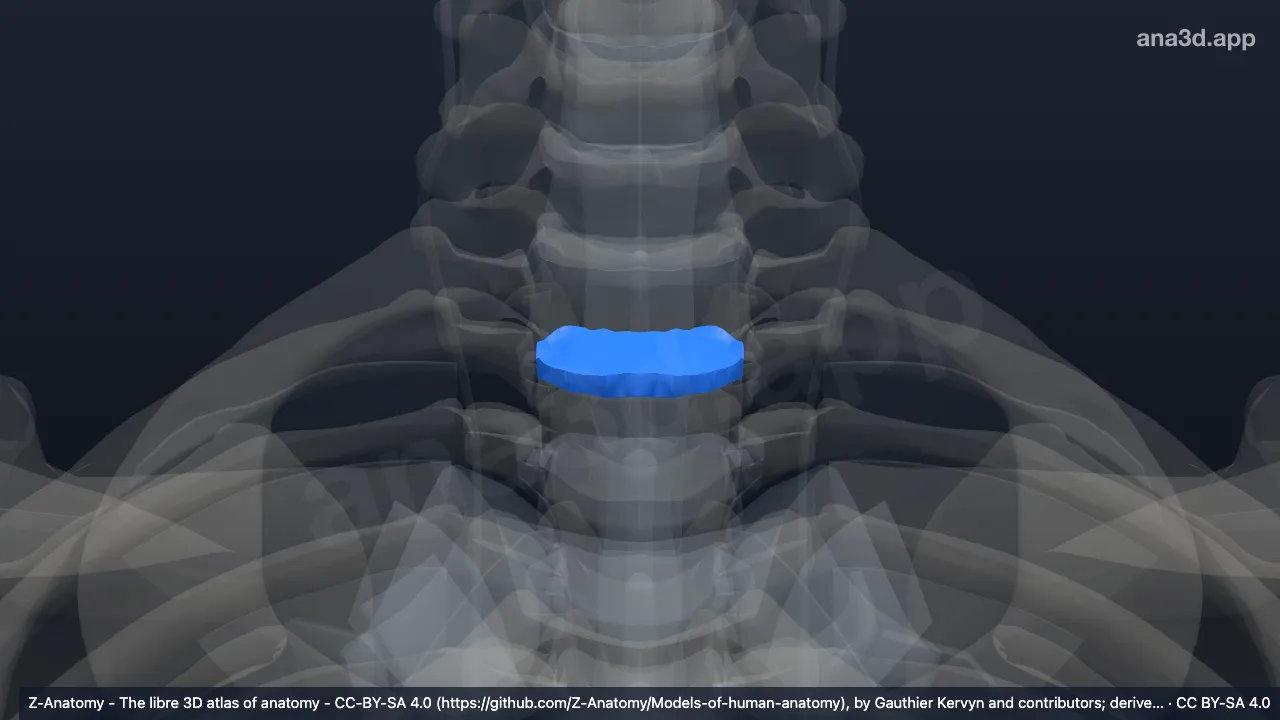 Model 3D: Diskus intervertebralis T1-T2