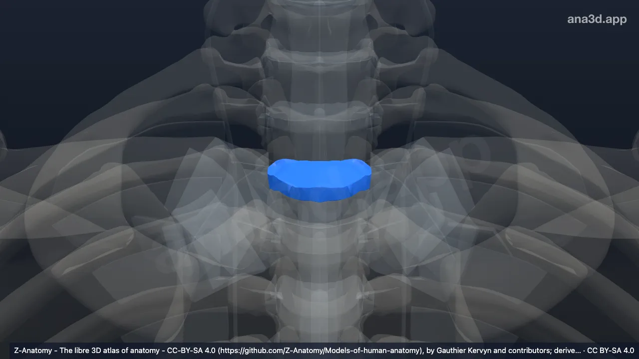 Model 3D: Diskus intervertebralis T2-T3